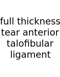 Full Thickness Tear Anterior Talofibular Ligament