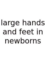 Large Hands And Feet In Newborns