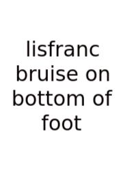 Lisfranc Bruise On Bottom Of Foot