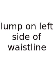 Lump On Left Side Of Waistline