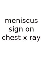 Meniscus Sign On Chest X Ray