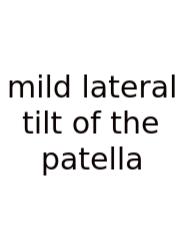 Mild Lateral Tilt Of The Patella