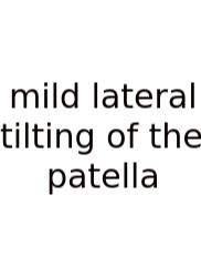 Mild Lateral Tilting Of The Patella