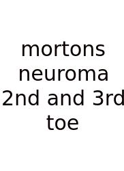 Mortons Neuroma 2nd And 3rd Toe