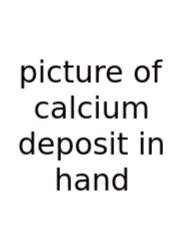 Picture Of Calcium Deposit In Hand