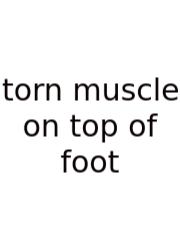 Torn Muscle On Top Of Foot