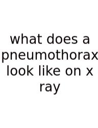What Does A Pneumothorax Look Like On X Ray