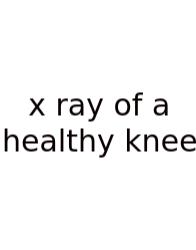 X Ray Of A Healthy Knee