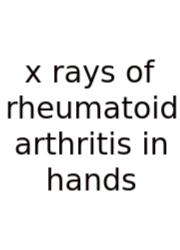 X Rays Of Rheumatoid Arthritis In Hands